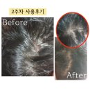 더마크지에프 | 탈모에 좋은 탈모영양제 비비스칼 탈모샴푸 리얼추천!!!