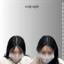 죽봉대로L | 광주두피 케어, 내 헤어라인에 딱 맞게 설계해 준 맞춤 상담! 스칼프나잇 후기