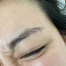 청담글래시피부과의원 | 청담 글래시피부과 의원 보톡스+속건조 관리 후기 파트 2