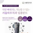 서울하우치과 이미지