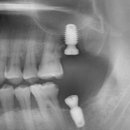 호평나무치과의원 이미지