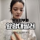 망포약국 | 망포피부과 영통피부과 앞광대필러 아띠에르 후기