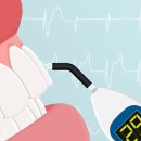 전기치수검사[Electric pulp test] 이미지