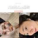 7308 | 안성 이브빈에스테틱 멜라리티 후기 부작용? 관리방법 꿀팁