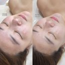 GS25 경산세명점 | 경산 시지 윤곽관리 맞춤케어 전문 에스테틱 물오른피부 경산점