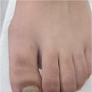 GS25진주장대점 | 진주 삼천포 발톱무좀 관리 안아프게 진짜 잘하는 곳 추천! 후네일&amp;베어진주장대점