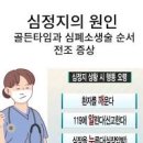 심정지 및 원인 (골든타임, 심폐소생술 순서) 이미지