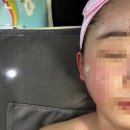 금환 | [난곡피부관리, 난곡마사지] 김도영 뷰티 에스테틱 : 페이스 + 금환 테라피 후기