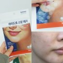 노스팟 | 가성비 트러블패치 추천 노브랜드 스팟패치 여드름 효과 후기