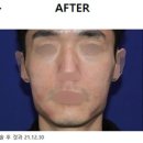 비스포크의원 이미지