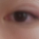 유망안과 네이버블로그
