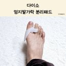 다이소 엄지발가락 분리 패드 무지 외반증 교정기 솔직한 사용 후기