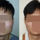제이제이 이재화성형외과