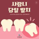 이고치과의원 | 당일 사랑니 발치 가능, 수원 더라인치과(feat. 환자분들의 찐 후기!, 사랑니 발치 전 꼭 체크해야할 것...