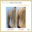 스마일테라피 이미지