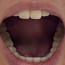 비에스치과의원 이미지