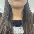 (주)레알 | 강남 페이스 코르셋 이중턱 (매선 실리프팅) 레알 찐 후기