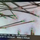 모멘텀헤어라인의원 이미지