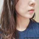 유독이쁨 | [올타이트 400샷 2차] 팔자주름/ 처진 얼굴/ 팔뚝라인 정리된 옥순 리프팅 후기