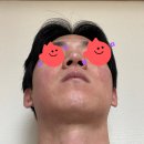 3-해율한의원 율각테라피 2회