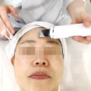 더마 리바이브 | 기미 잡티 관리 송도 더마 리바이브에서 에스테틱 합법 레이저 엑스터로 관리받고 왔어요