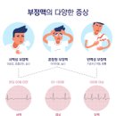 빈맥 증상 및 원인 (빈맥성 부정맥, 심실, 기립성빈맥증후군) 이미지