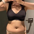 차중 | 복부 지방분해주사 5회차 생리 중 시술과 눈바디 후기