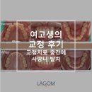 남지치과의원 | [풍무동 교정치과] 교정치료 중 사랑니 발치