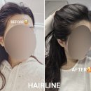 팡팡 | 합정 유주얼 헤어라인문신 후기｜헤어팡팡 기법으로 자연스럽게 어려보이기