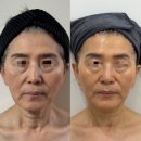 오프유 - 성북구 | 결혼 앞두고 제대로 빠짐! 회기동 오프유 에스테틱 리얼 후기💆 ♂️