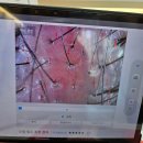 생장 | [인천 학익동] &#39;MO100 모발생장집중프로그램&#39; 솔직 후기