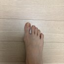 발가락교정기 찾다가 알게된 케어링 발가락링 후기