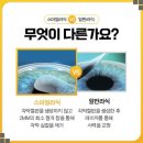 광주스마일안과의원 이미지