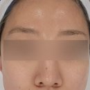 구로-구로-구로-2668 | 강남피부관리 하이필스킨 맞춤관리로 장벽 복구 완료