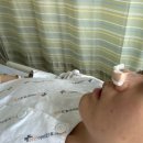 다인이비인후과병원 | 부평 다인이비인후과 비염수술 하비갑개 고주파 시술 당일 퇴원 후기