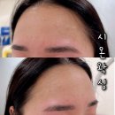 시온홈케어 | 동래구왁싱 추천 눈썹 헤어라인왁싱 연산동 시온왁싱 후기