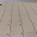 기능발전 이미지