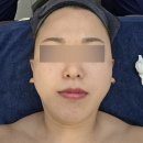 이서경스킨앤바디케어 | 안산 본오동 피부관리 "가꾸미 스킨앤바디" 웨딩케어 후기☺️