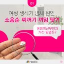 리베리의원 화성병점 | 병점역산부인과 여성 생식기 냄새 유발하는 소음순 찌꺼기 개선책