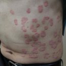 소문생생한의원 이미지