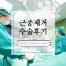 로봇복강경 자궁근종제거 수술후기 및 회복팁, 준비물