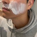 일산주엽톡스앤필의원 | [추천] 남자수염제모/레이저제모/남성제모/톡스앤필