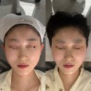 담에스테틱 | 📍세종 신부관리 - 수예담에스테틱 이중턱 부수기 대만족 후기!