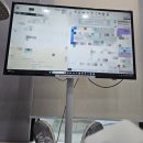 동탄아이비치과의원 | 동탄 임플란트 11개월 치료 과정 후기 및 가격 (내돈내산) _ 내이튼치과