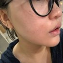 스포츠 토탈 케어 | [노원] 노원 화이트태닝 | 노원 피부관리 얼짱몸짱뷰티클럽 노원점 추천 후기