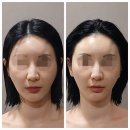 조성에너지 - 4131 | 일산 행신동 체형관리 ｜챠밍SnB 라이번에너지 테라피 후기