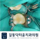 윤치과기공소 이미지