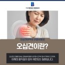 가양바른성모정형외과의원 | 등촌역 정형외과 팔이 뒤로 안 돌아간다면 오십견일 수 있습니다