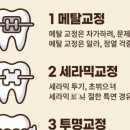 서래선치과의원 네이버블로그