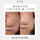 [진주 피부관리] 진주 하대동 아다한에서 물방울 리프팅 해본 솔직한 후기